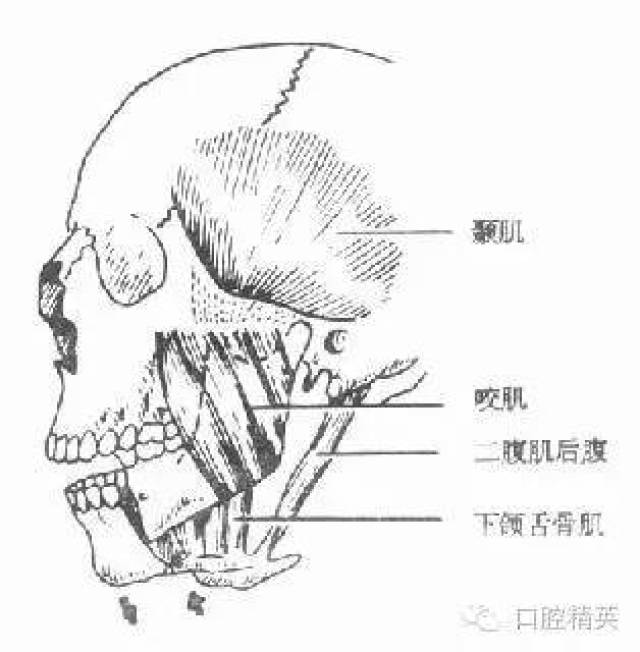 图4-14 颏孔部骨折后骨折段移位情况