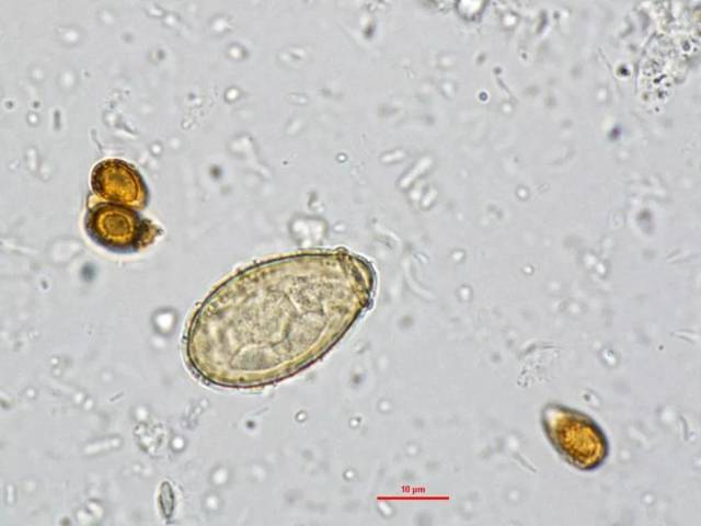 专家专栏 | 肝吸虫卵vs灵芝孢子,你还傻傻的分不清吗?