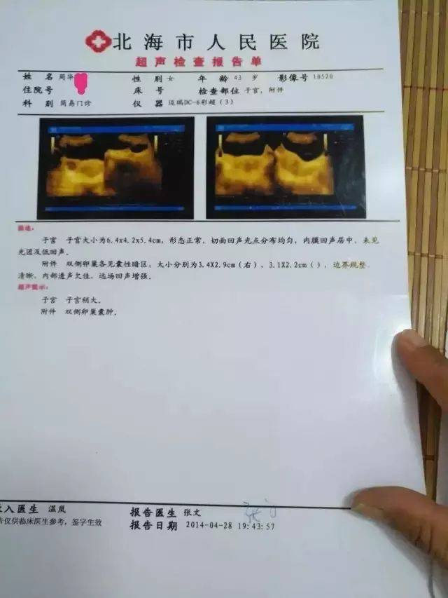 李氏砭法|砭治卵巢囊肿及输卵管积水