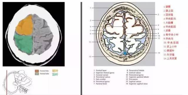 ( 大脑外侧面观) 颅脑ct断面解剖图谱