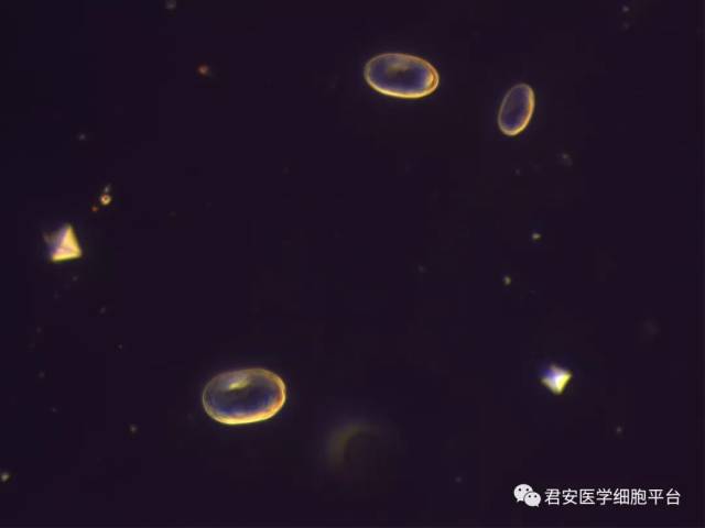 我可以方,也可以圆,但我还是我——形态多变的草酸钙结晶