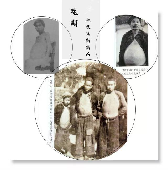 60年的坚守与执着 血吸虫病在广西"消失,这群人功不可没!