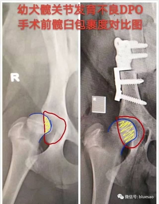 【病例分享】萨摩左腿髋关节发育不良,安徽佰陆dpo矫正手术临床病例