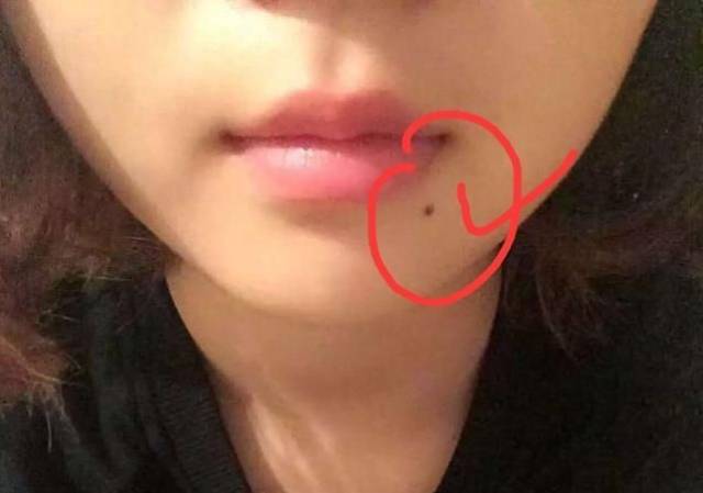眼睛上面的痣属于典型的富贵痣,男命主易有横财,女命主则主旺夫之相