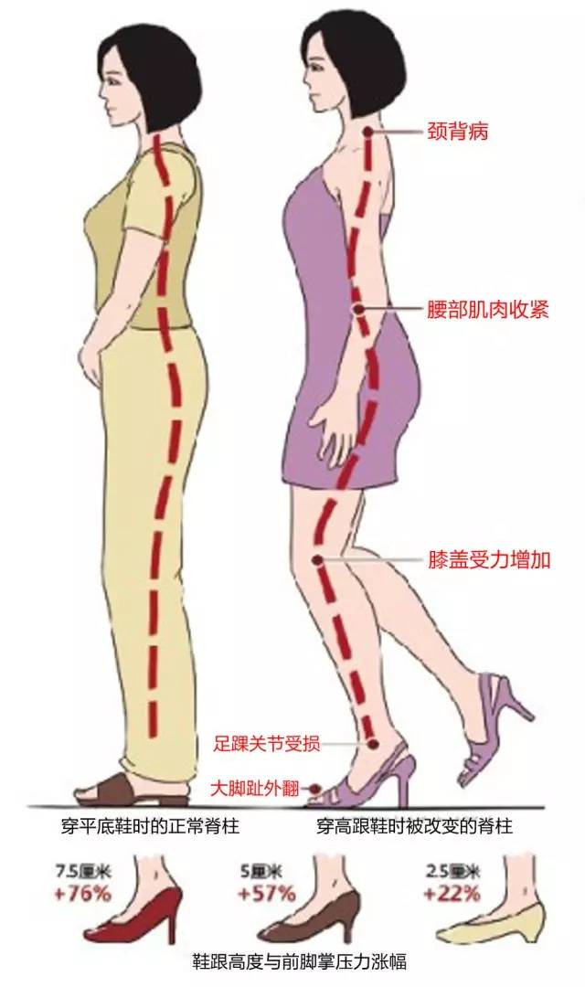 习惯塌腰,就有种拗造型的意思.