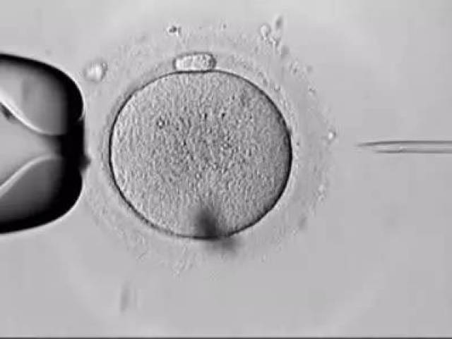 胚胎质量差,第二代试管婴儿技术能解决吗?