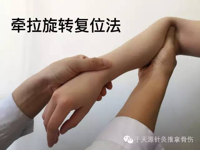 《听故事学推拿026》详解桡骨头半脱位整复手法