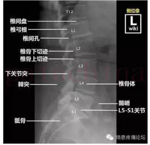 疼痛相关x线读片基础