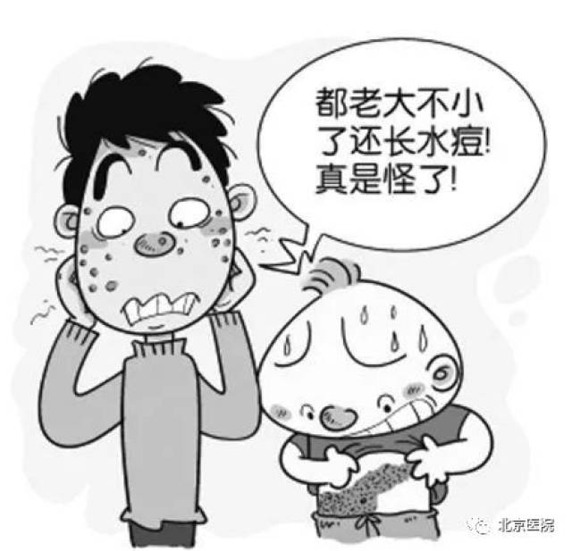 q:带状疱疹会传染吗?