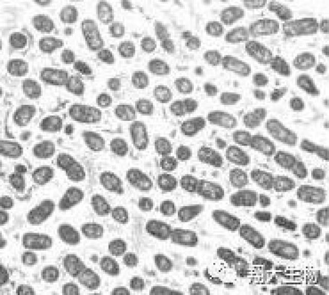 胸膜肺炎放线杆菌 是革兰氏阴性菌,有荚膜的多形性小球杆菌,在血液
