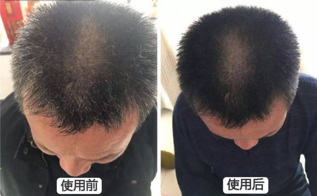 满头白发不用染!这样洗头能变黑,比去100次美发店都有用!