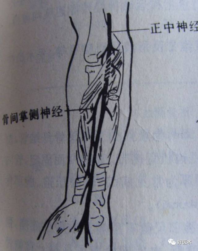 系统详解:8种常见周围神经卡压综合征