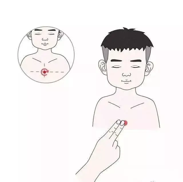 咳嗽还在吃止咳药?巧医生送你全套推拿手法,赶紧用起来!
