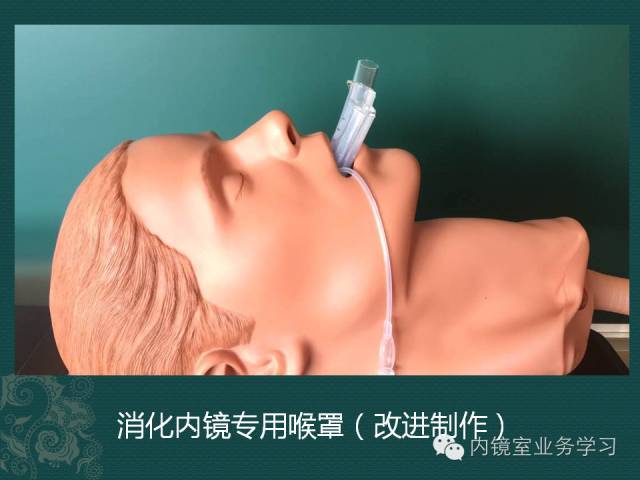 内镜操作中的气道管理(气管插管与消化内镜喉罩)