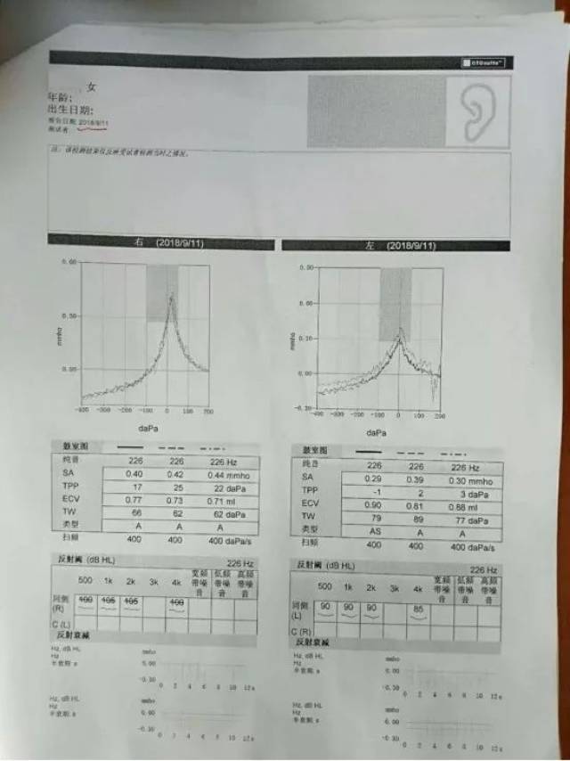 医生开的检查项目: 1,纯音听阈测定1次; 2,声导抗测听(多频率)1次