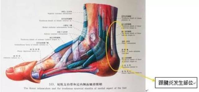 跑步课堂深度了解跟腱炎的预防与治疗