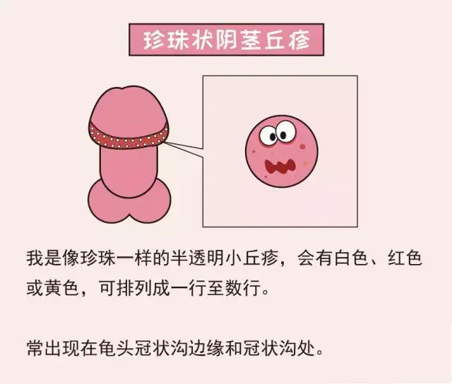 丁丁上有小疙瘩是xing病吗?