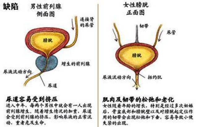 3,尿泡沫和前列腺炎