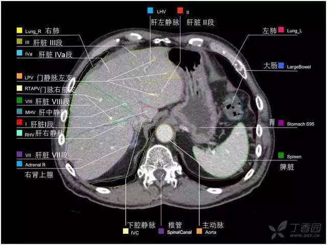 最实用的上腹部 ct 图谱,看过的医生都收藏了