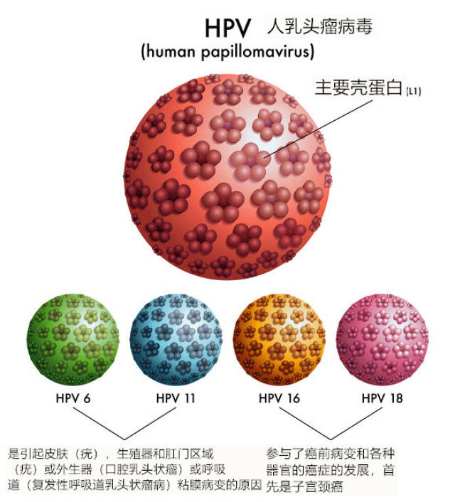 感染hpv后,还可能引起一些恶性肿瘤: 外阴癌,阴茎癌,肛门癌,前列腺癌