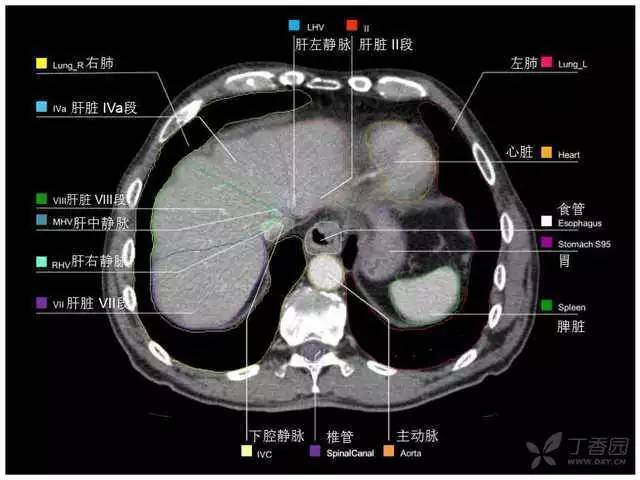 最实用的上腹部 ct 图谱,看过的医生都收藏了