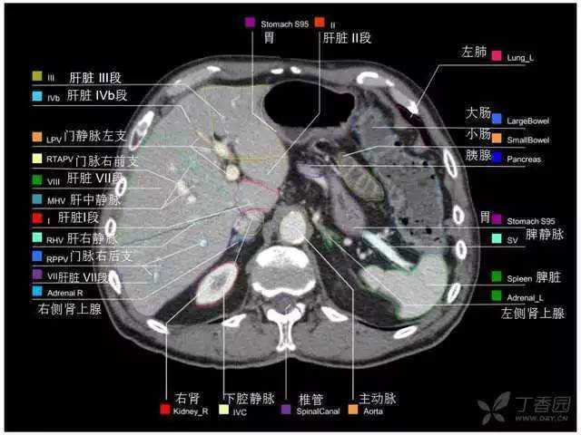 最实用的上腹部 ct 图谱,看过的医生都收藏了