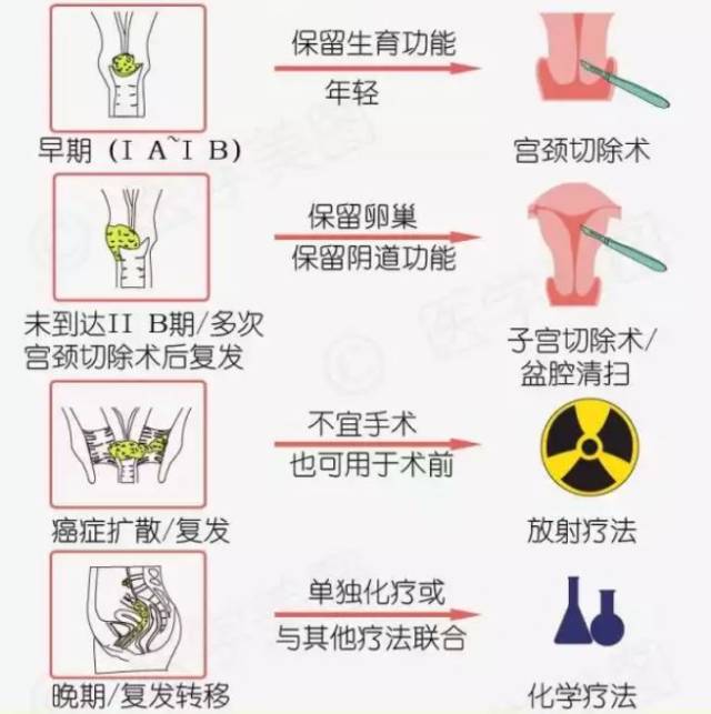 女性朋友注意了!4步带你了解宫颈癌