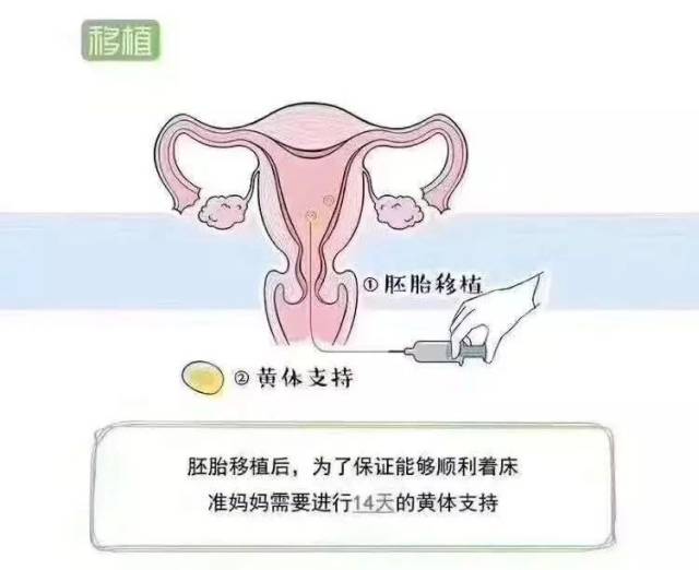 【泰国新希望】试管婴儿的流程你造吗?