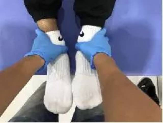 仅仅一周X型腿变直?原来他做了这几个动作