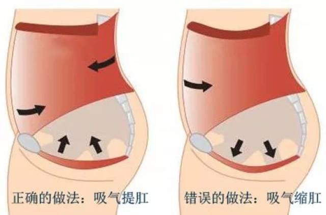 阴道前后壁膨出修复术是什么 关于阴道前后壁膨出修复