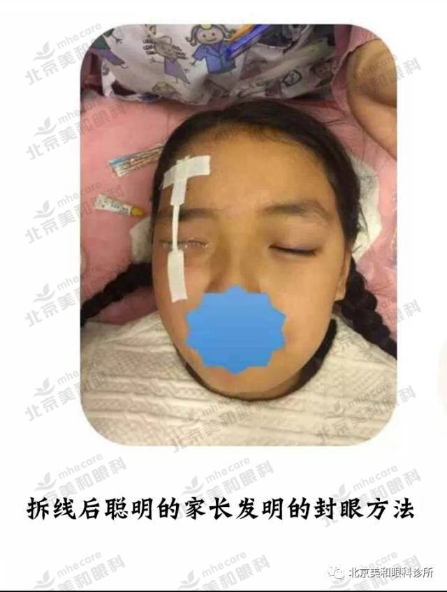 上睑下垂十全大补丸-于刚爷爷门诊日记3(视频