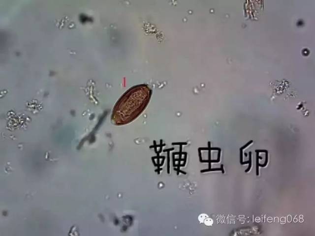显微镜下的寄生虫原来长这样