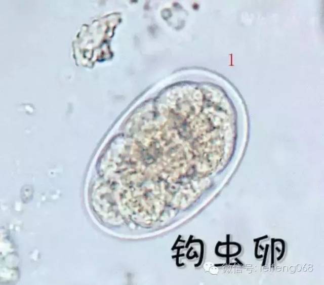 显微镜下的寄生虫原来长这样