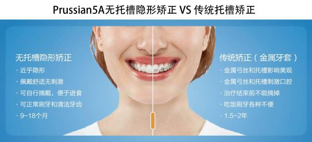 牙齿矫正的优点有哪些