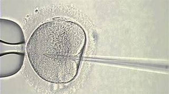 四代之第二代:单精子卵细胞浆内注射 ICSI