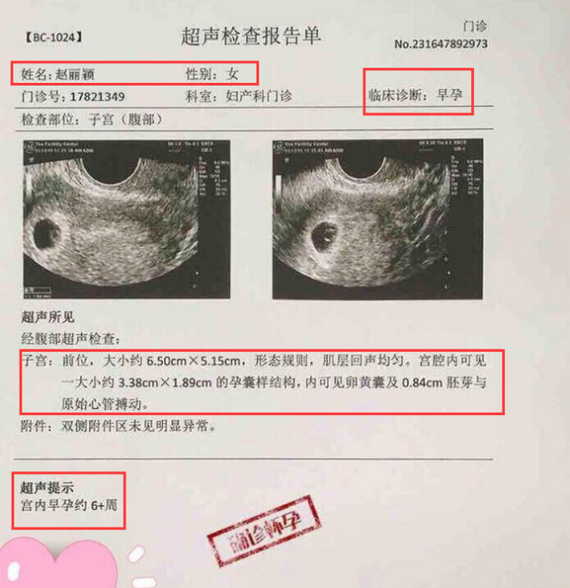 赵丽颖b超产检报告曝光,宫内早孕六周,检测到胚芽和胎心搏动