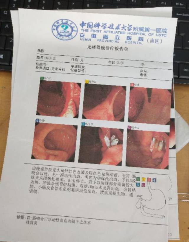 我得了先天性心脏病,精神分裂症,胃大部分切除,胃杜氏病.重度贫血.