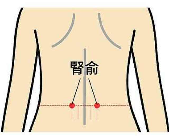 肺气虚喉咙有痰艾灸哪些穴位?