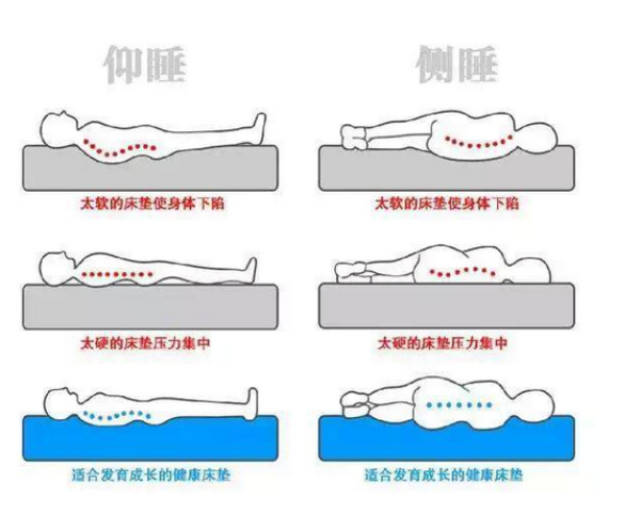 不合适的床垫危害青少年脊椎