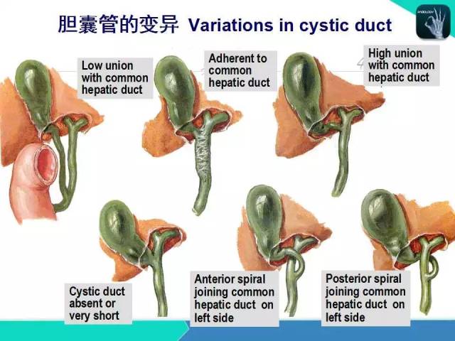 精品课件 肝胆,门静脉解剖