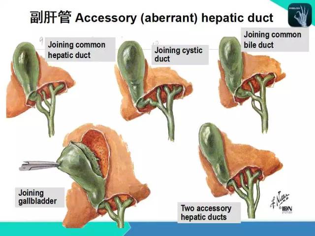 精品课件 肝胆,门静脉解剖