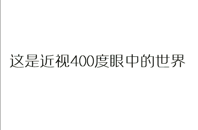 一旦发展至高度近视(度数超过600度,眼轴长度大于26毫米): 青光眼