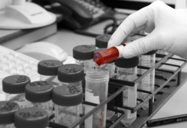 24岁女孩因手心痒查出肺癌,专家:只要身体3处