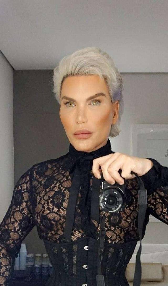 后悔莫及!花24万摘除四根肋骨,只为纤细苗条,如