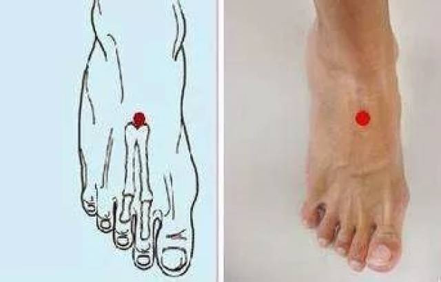 血管堵,疾病生!93岁国医大师的独家秘方,让你