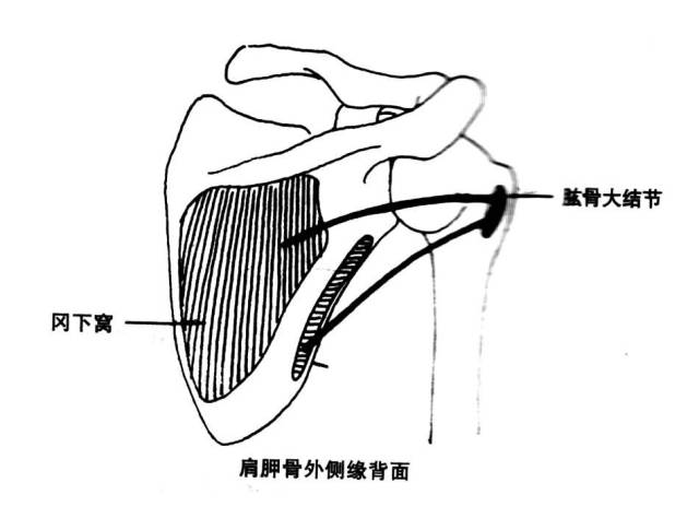 令人头疼的肩关节半脱位的治疗法宝一