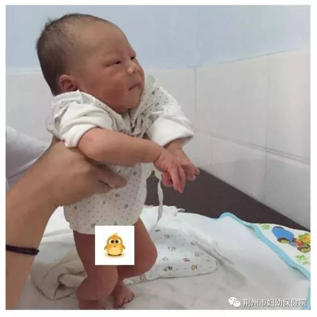 [权威发布]新生儿出生两天后,如何判定他健康不健康|新生儿两天