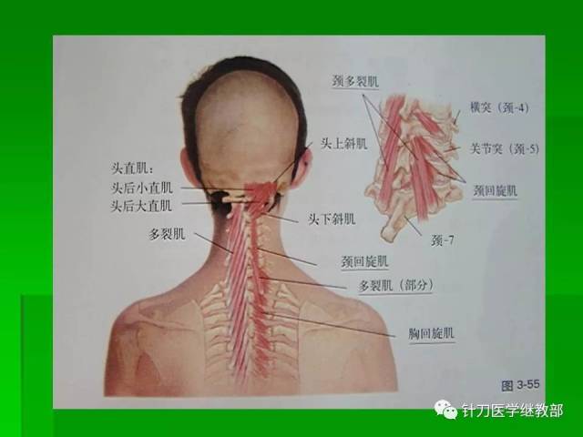 颈肌肉及颈脊神经的功能解剖