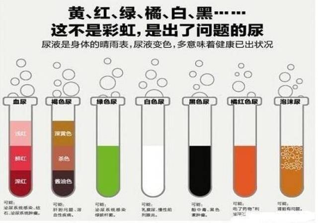 (2)酱油色,浓茶色尿液 尿液呈现此种颜色是因为血红蛋白增多导致