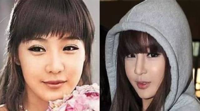 看到这,大家似乎也了解了朴春的改变目标吧,就是从成熟脸向逆龄娃娃脸
